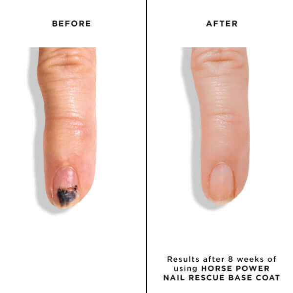 Horse Power Nail Rescue Base Coat - butterlondon-shopnail treatments